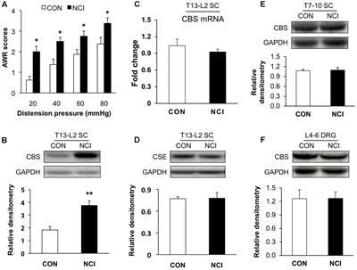 Neonatal Colonic Inflammation Increases Spinal Transmission and Cystathionine β-Synthetase Expression in Spinal Dorsal Horn of Rats with Visceral Hypersensitivity